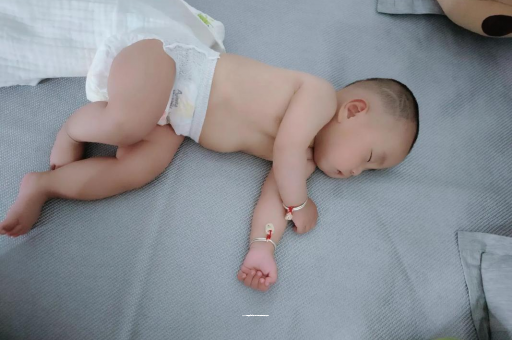 淄博六个月宝宝眼睛散光